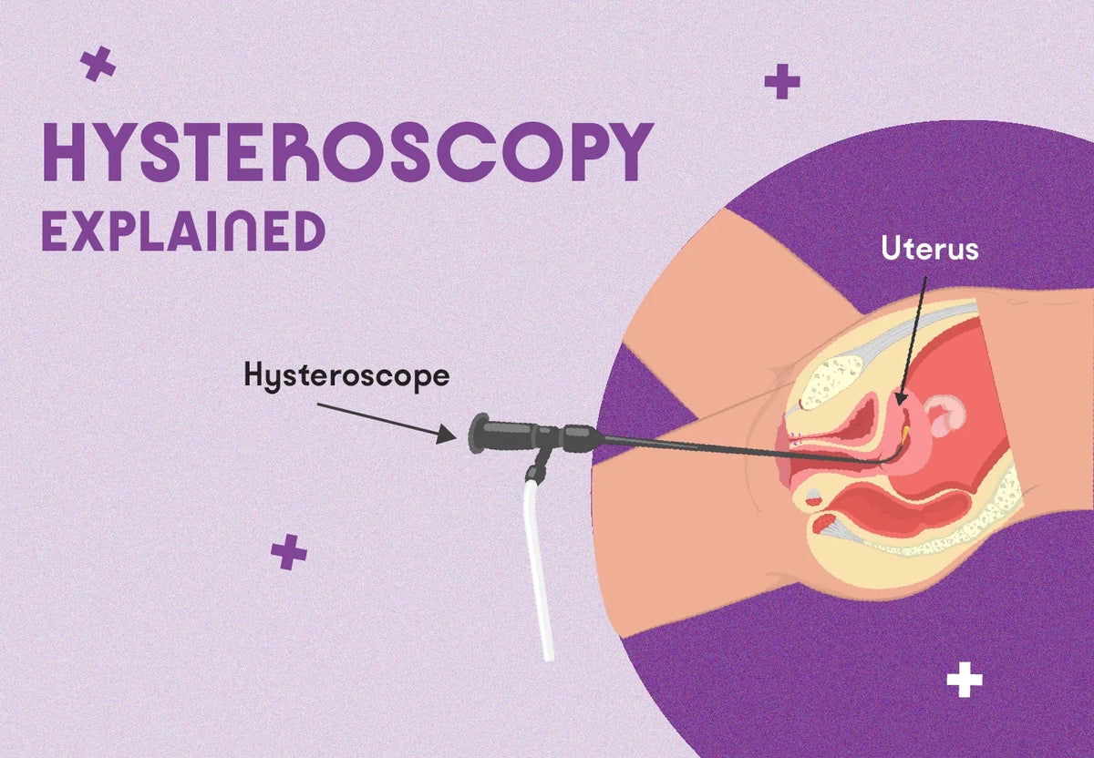 Calm three-panel timeline labelled before, during, and after, showing the path of a hysteroscope through the cervix without graphic detail