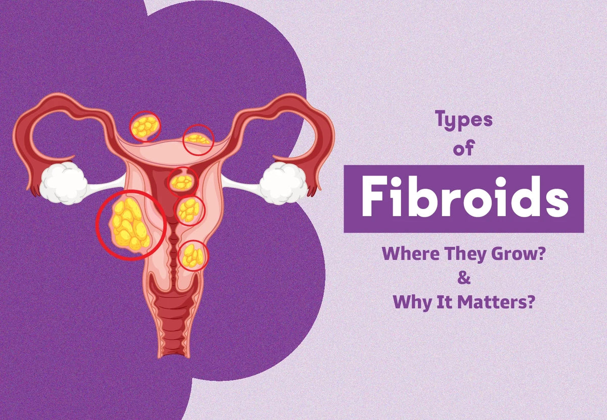 Types of Uterine Fibroids: Where They Grow and Why It Matters