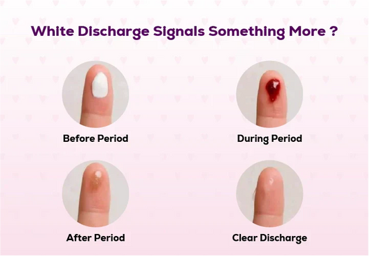 Illustration explaining normal white vaginal discharge and women's intimate health awareness