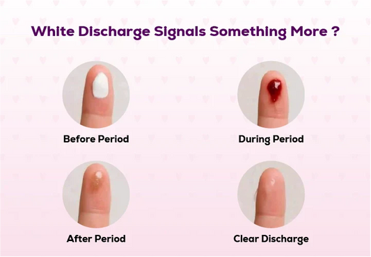Illustration explaining normal white vaginal discharge and women's intimate health awareness